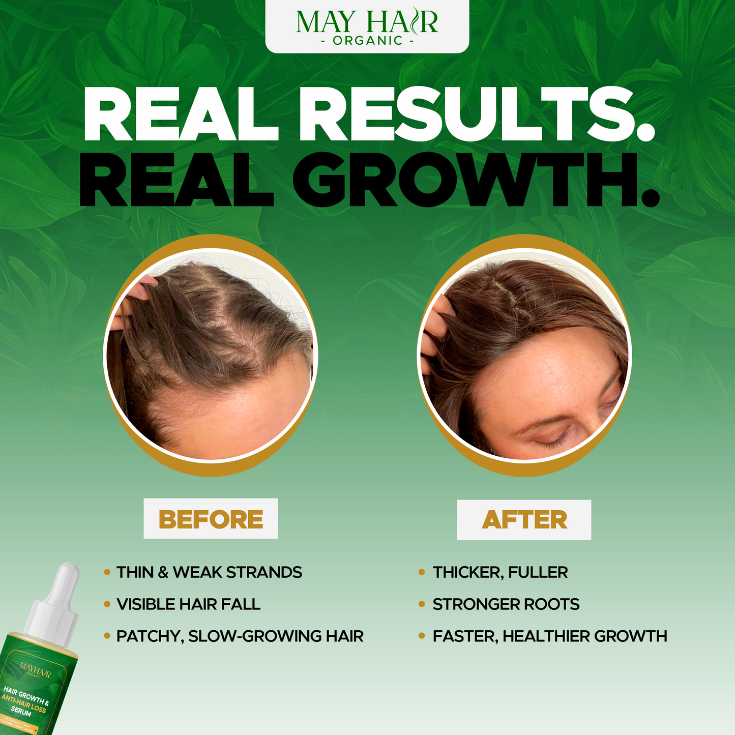 Hair Growth & Anti-Loss Oil - May Hair Organic™