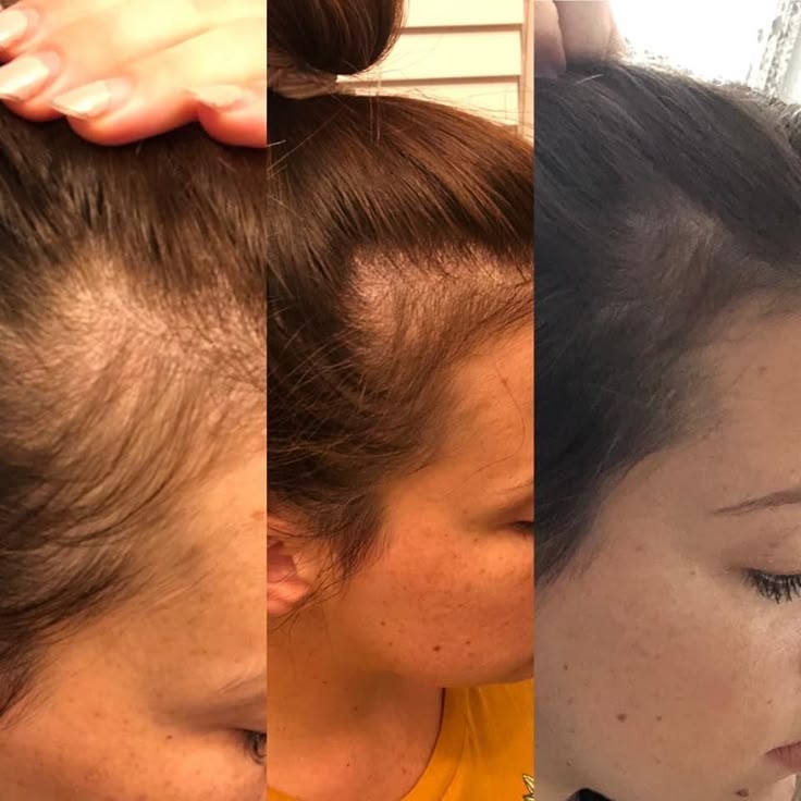 Hair Growth & Anti-Loss Oil - May Hair Organic™