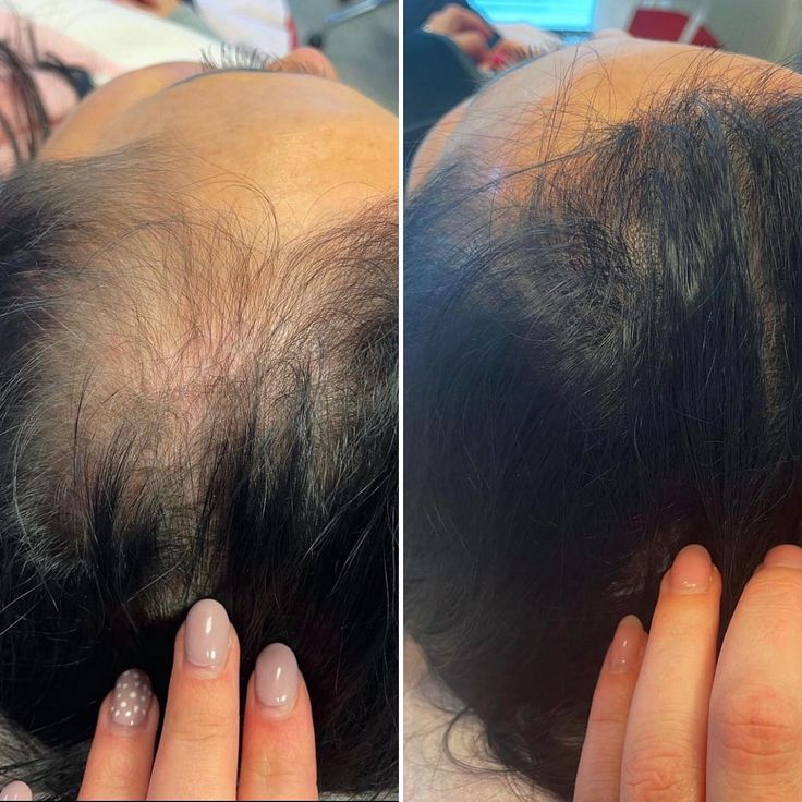 Hair Growth & Anti-Loss Oil - May Hair Organic™