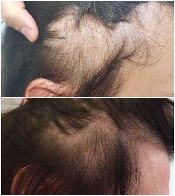 Hair Growth & Anti-Loss Oil - May Hair Organic™